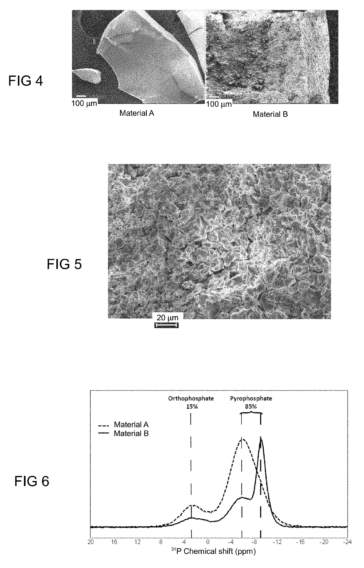 Pyrophosphate type material, process for preparing such a material and use for bone repair