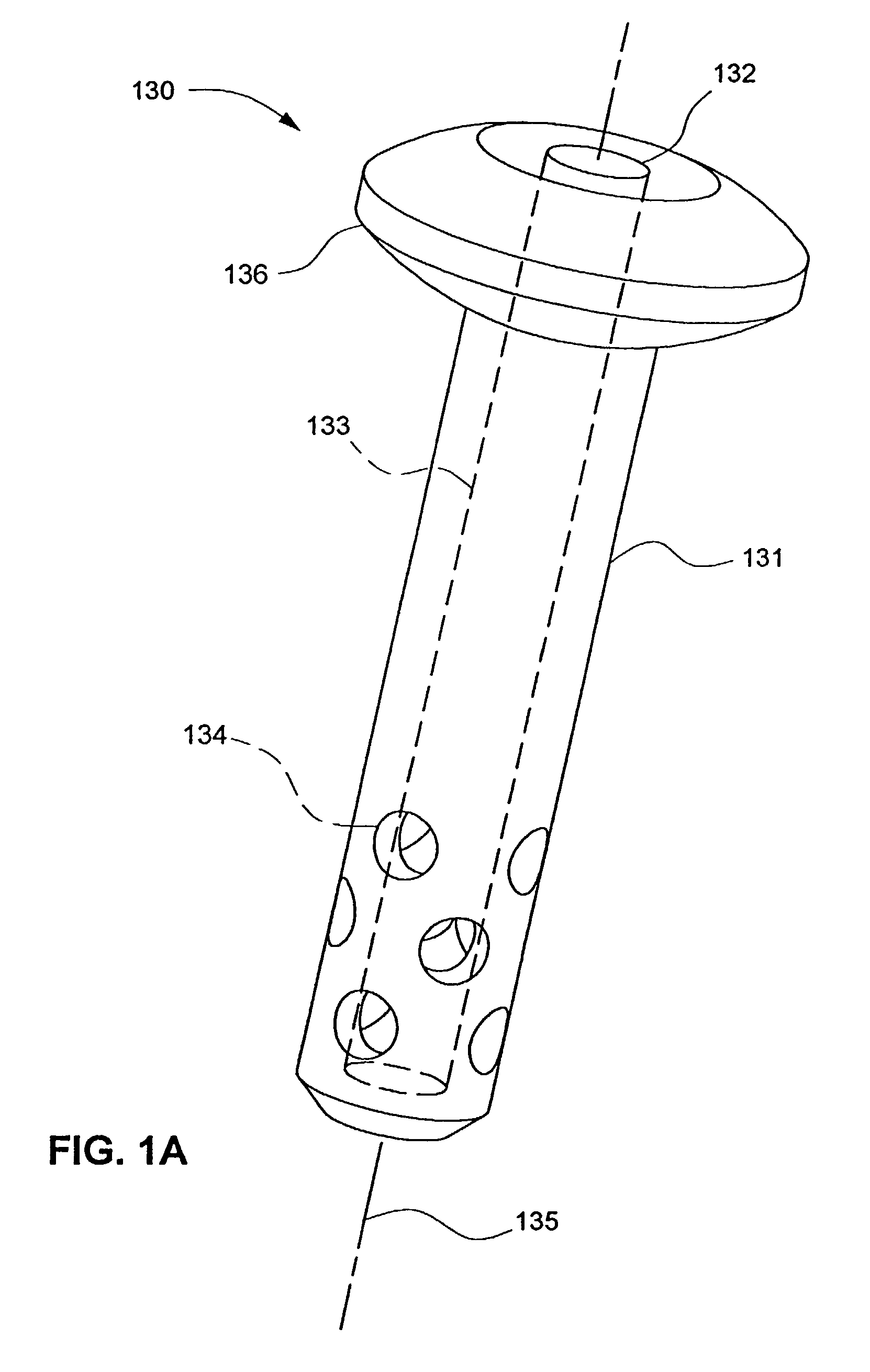 Orthopaedic implant fixation using an in-situ formed anchor