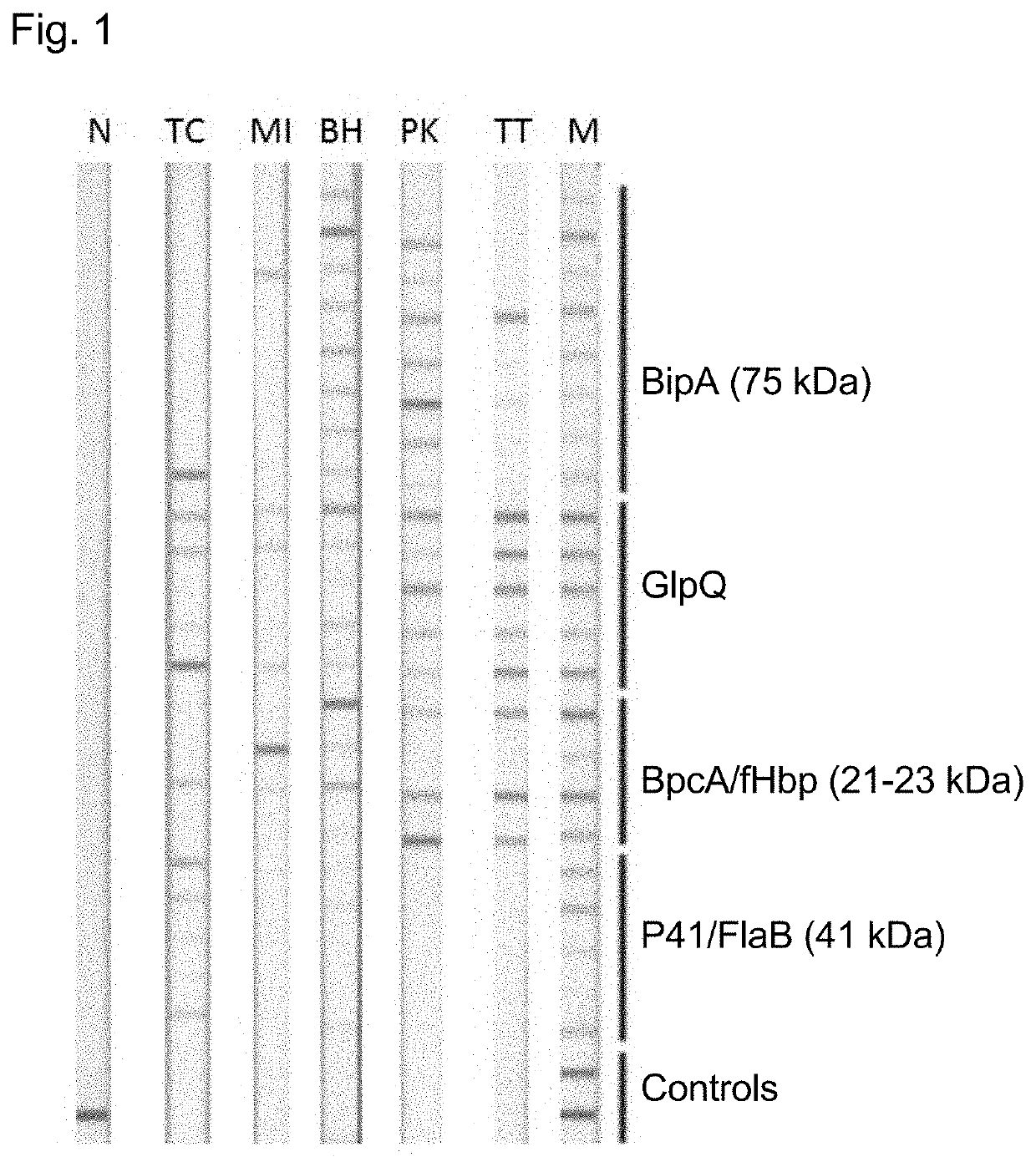 Species-specific antigen sequences for tick-borne relapsing fever (TBRF) and methods of use