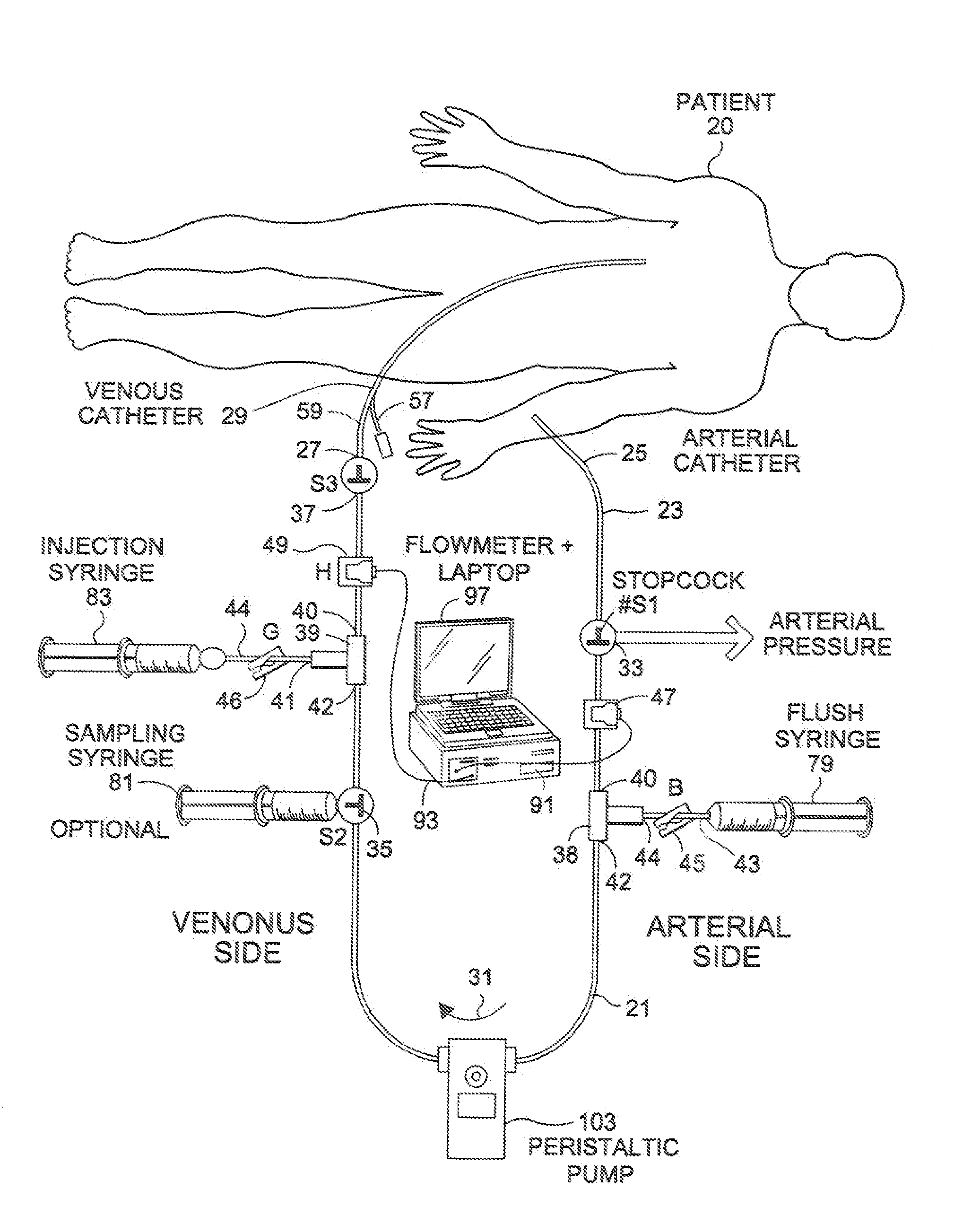 System and method for diverting flow to facilitate measurement of system parameters