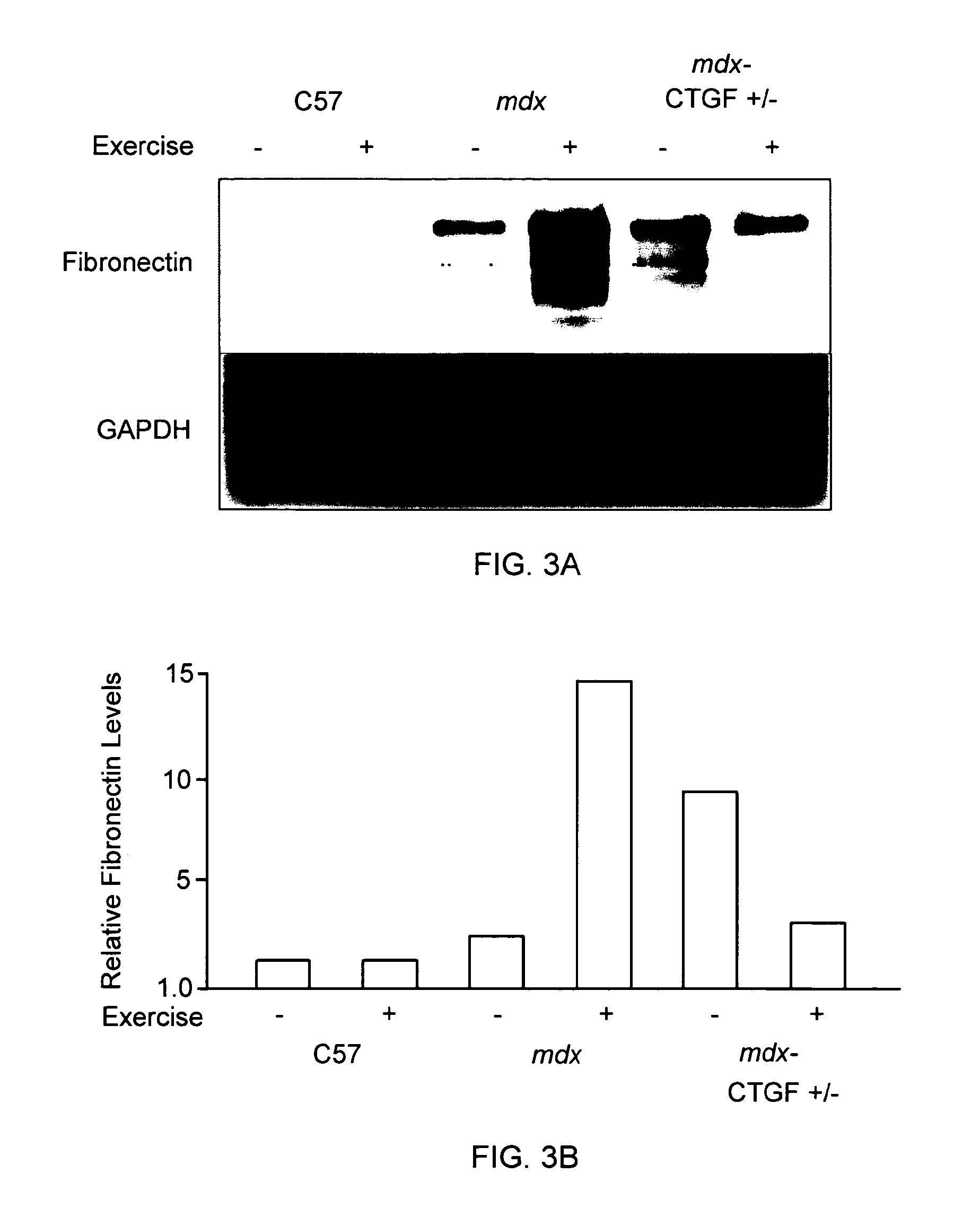 Methods for treatment of muscular dystrophy
