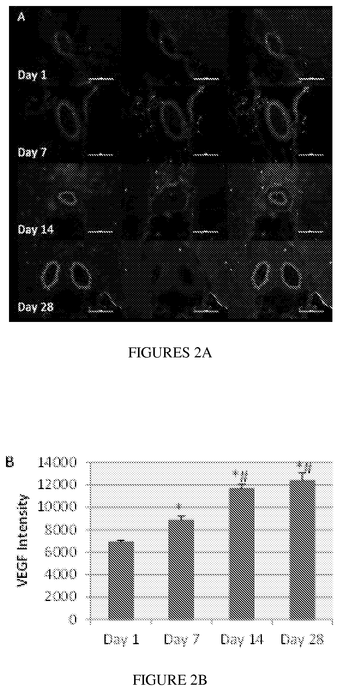 Compositions and methods for treating neuropsychiatric disorders using an endothelin-B receptor agonist