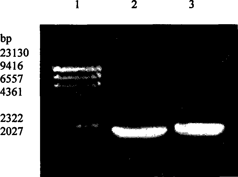 Recombinant bacteria expressing avian Escherichia coli type 1 pilin, and construction method and use thereof