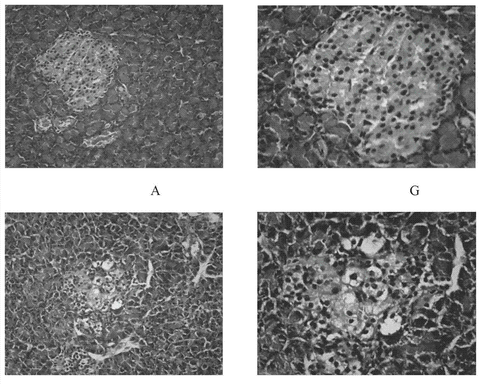 Applications of Tianshen capsules in preparation of drug used for treating type 2 diabetes lipid metabolic disorders and atherosclerosis