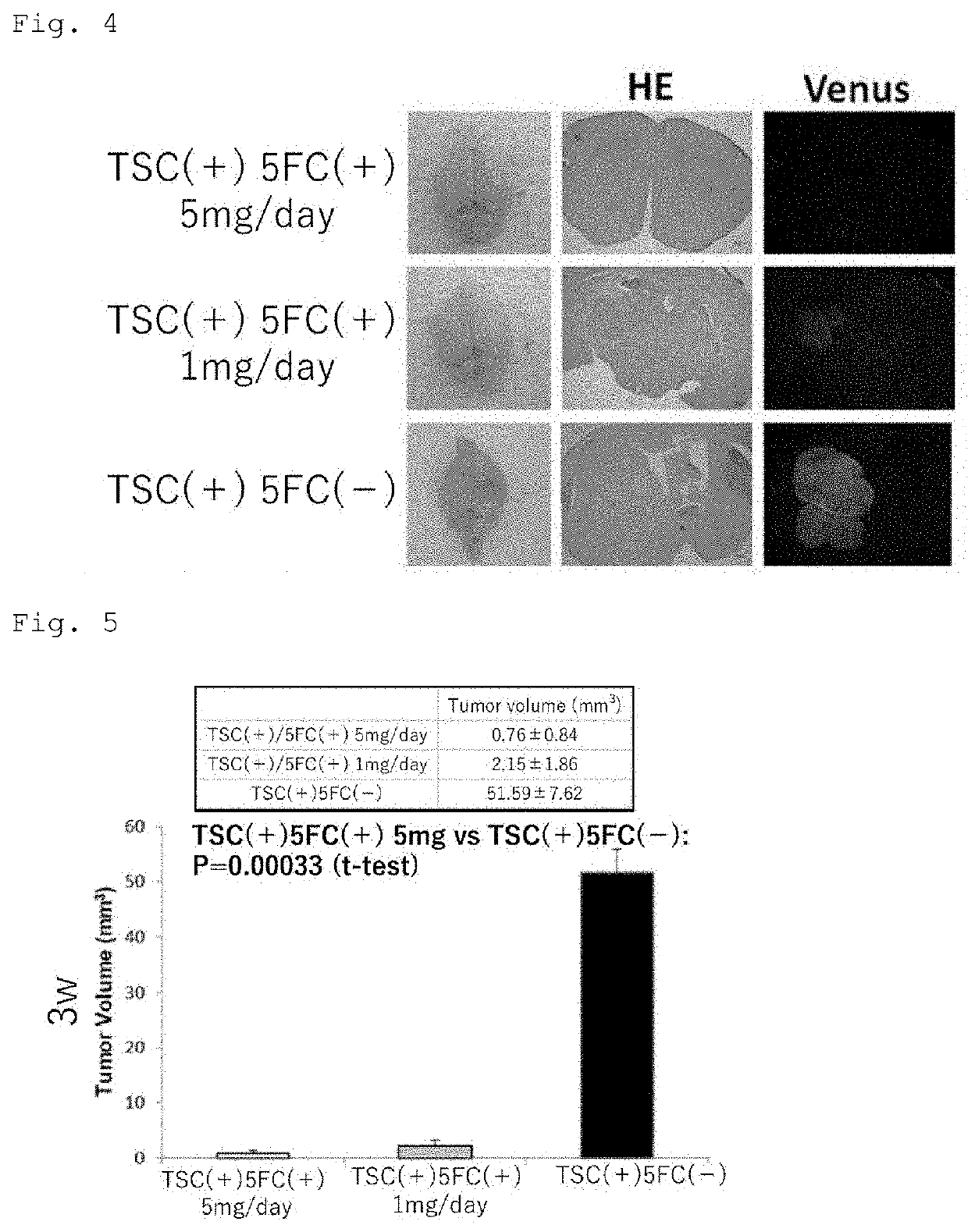 Suicide gene therapeutic agent for brain tumors using pluripotent stem cell