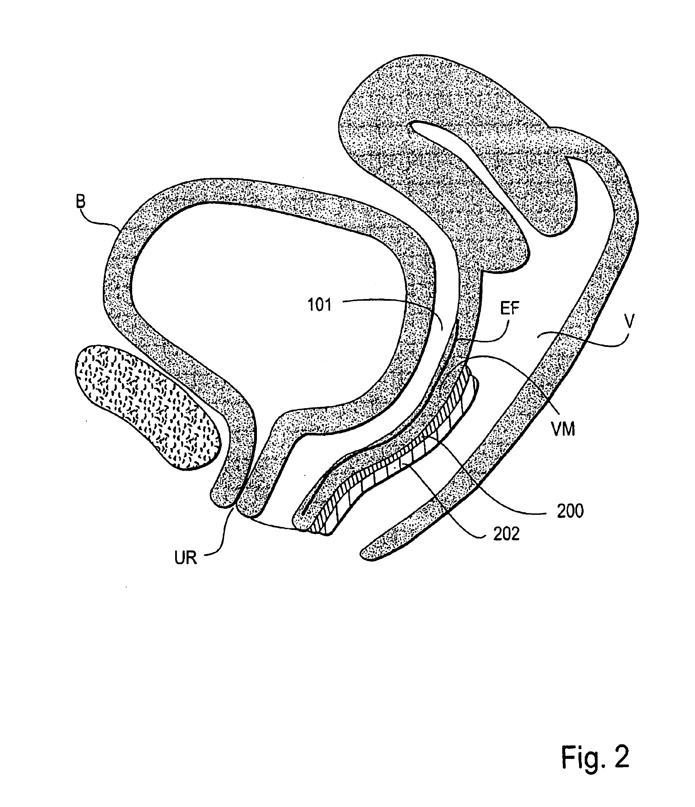 Systems and methods using vasoconstriction for improved thermal treatment of tissues