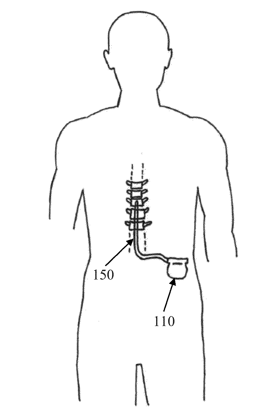 Method and Apparatus for Detecting Neural Injury