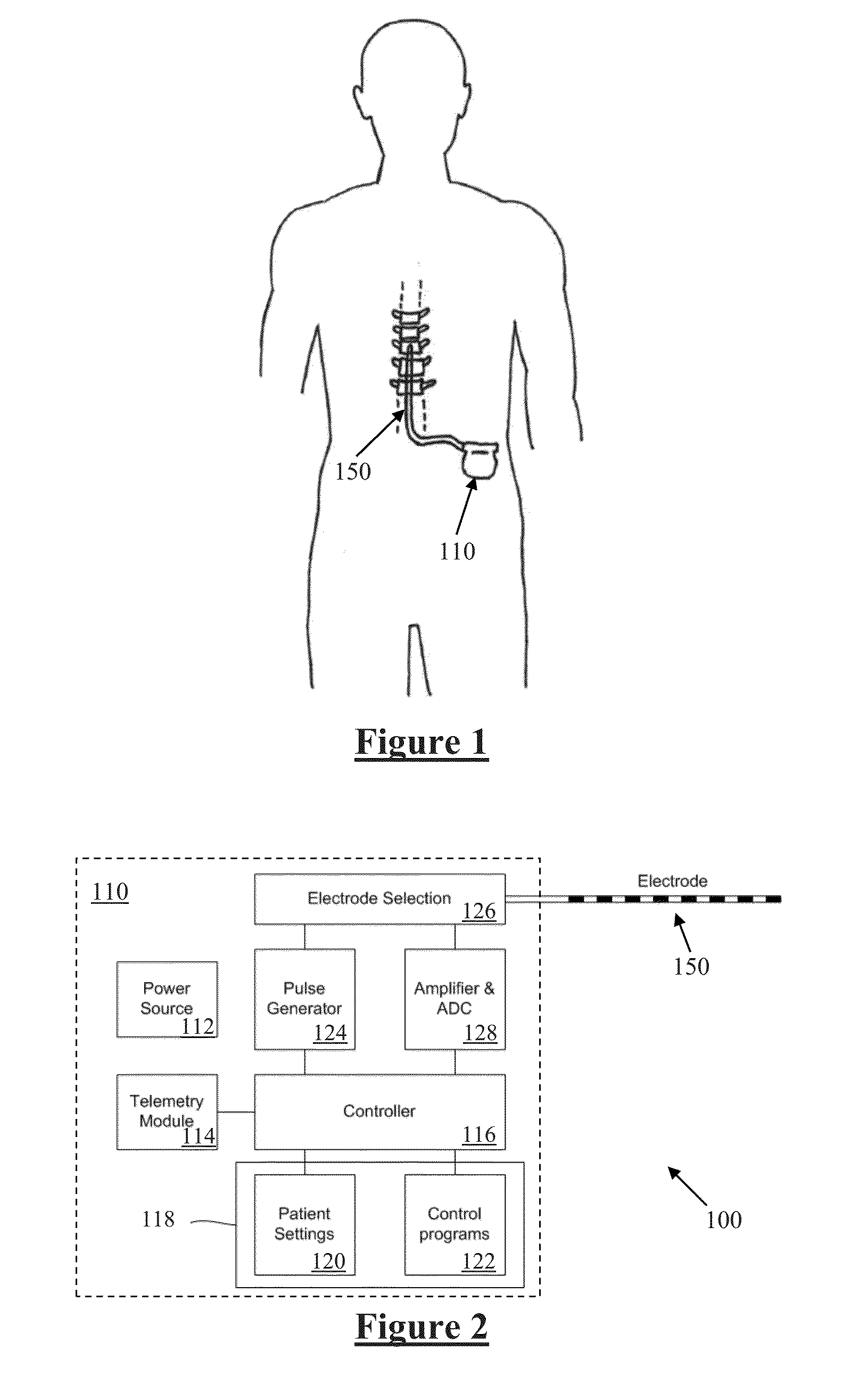 Method and Apparatus for Detecting Neural Injury