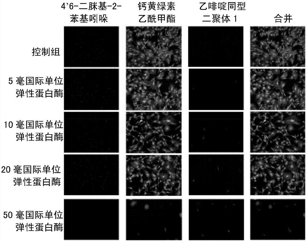 Application of burdock extract in preparing medicine for protecting elastic fibers and collagen