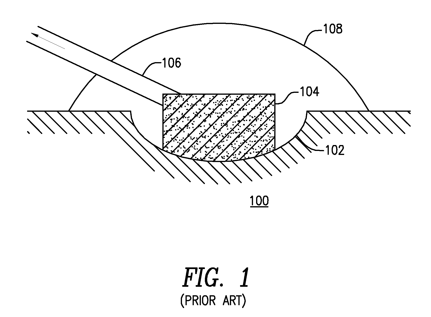 Systems and methods for providing a debriding wound vacuum