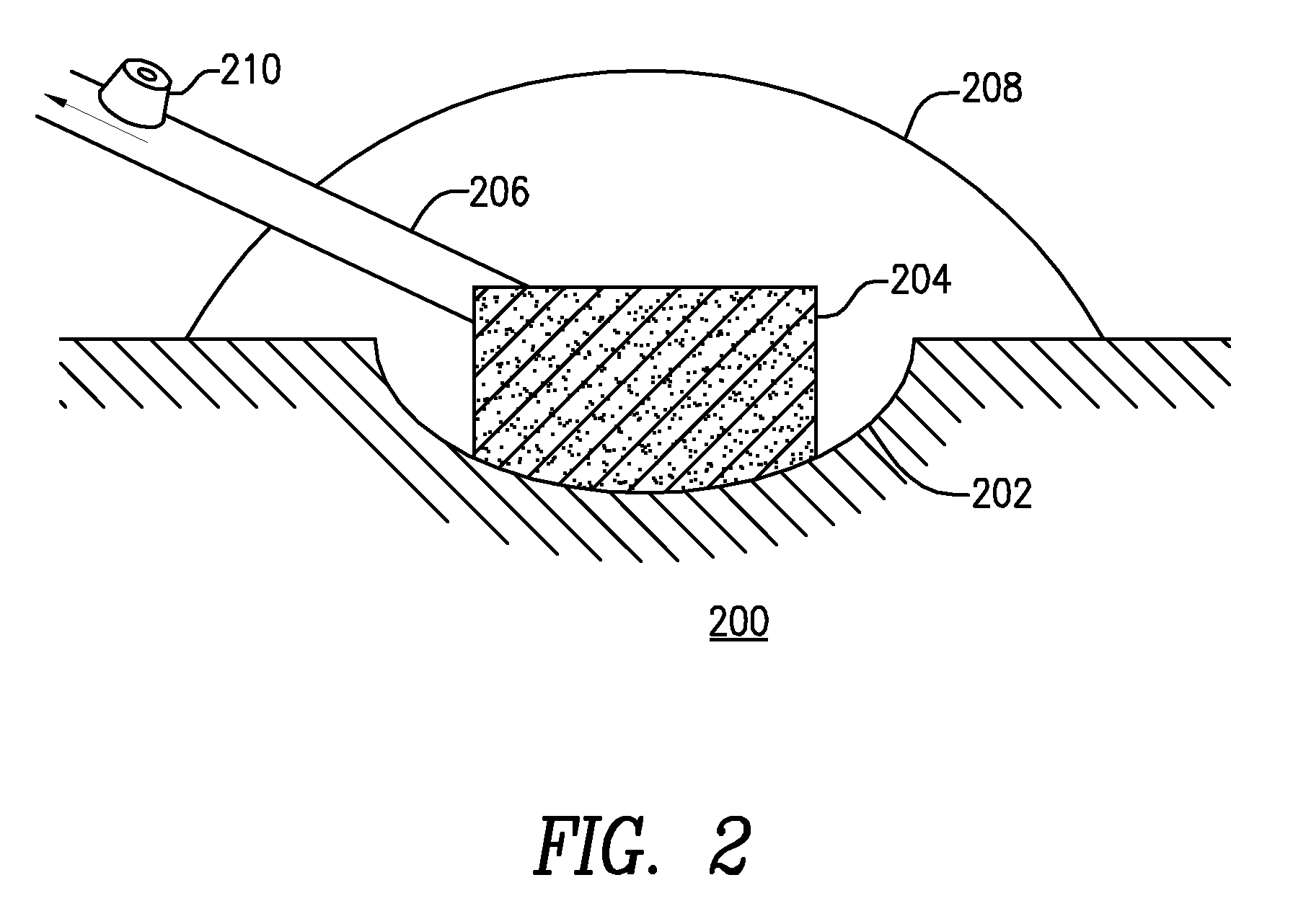 Systems and methods for providing a debriding wound vacuum