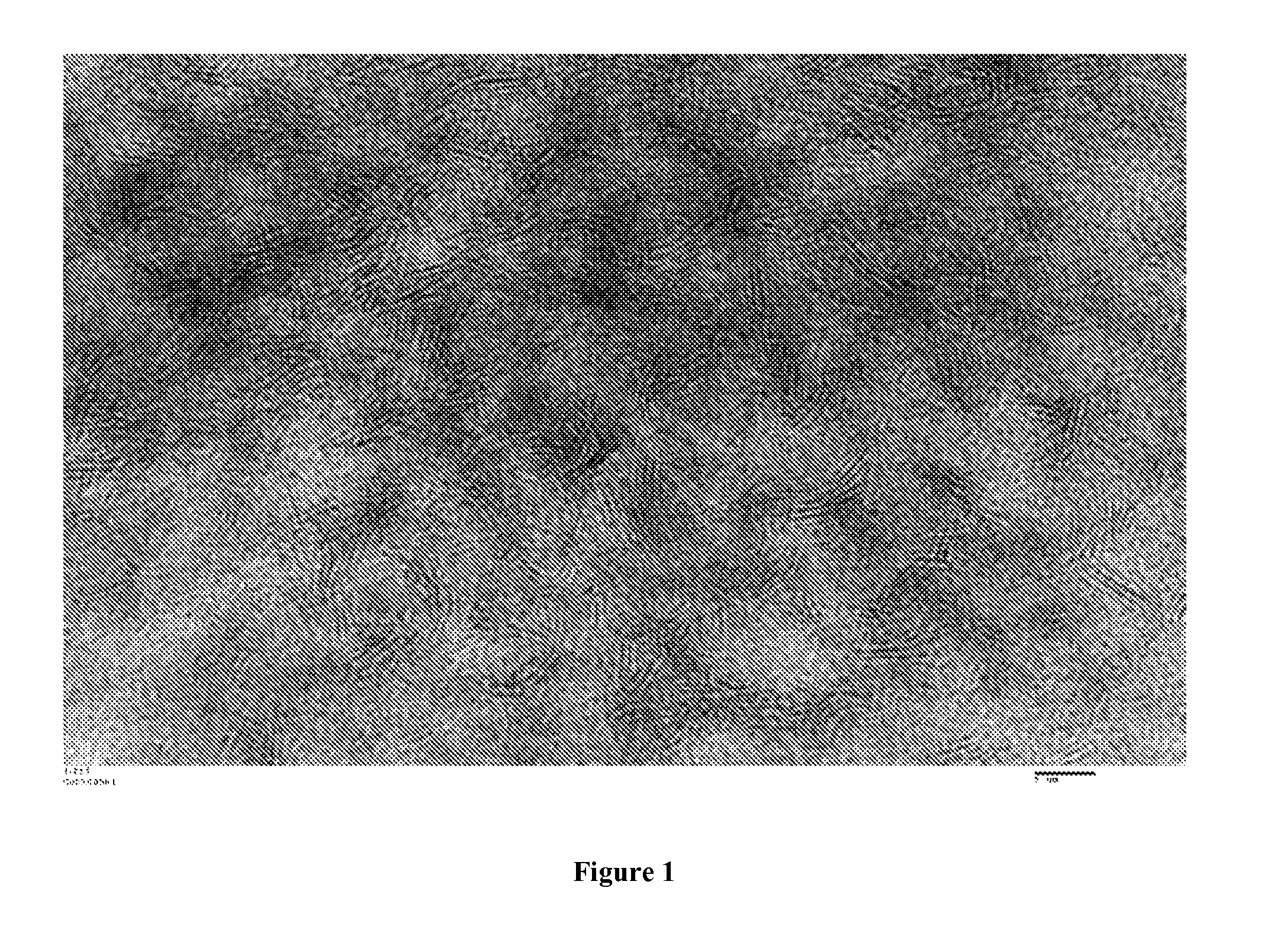 Hydrotreating catalyst and process for preparing the same