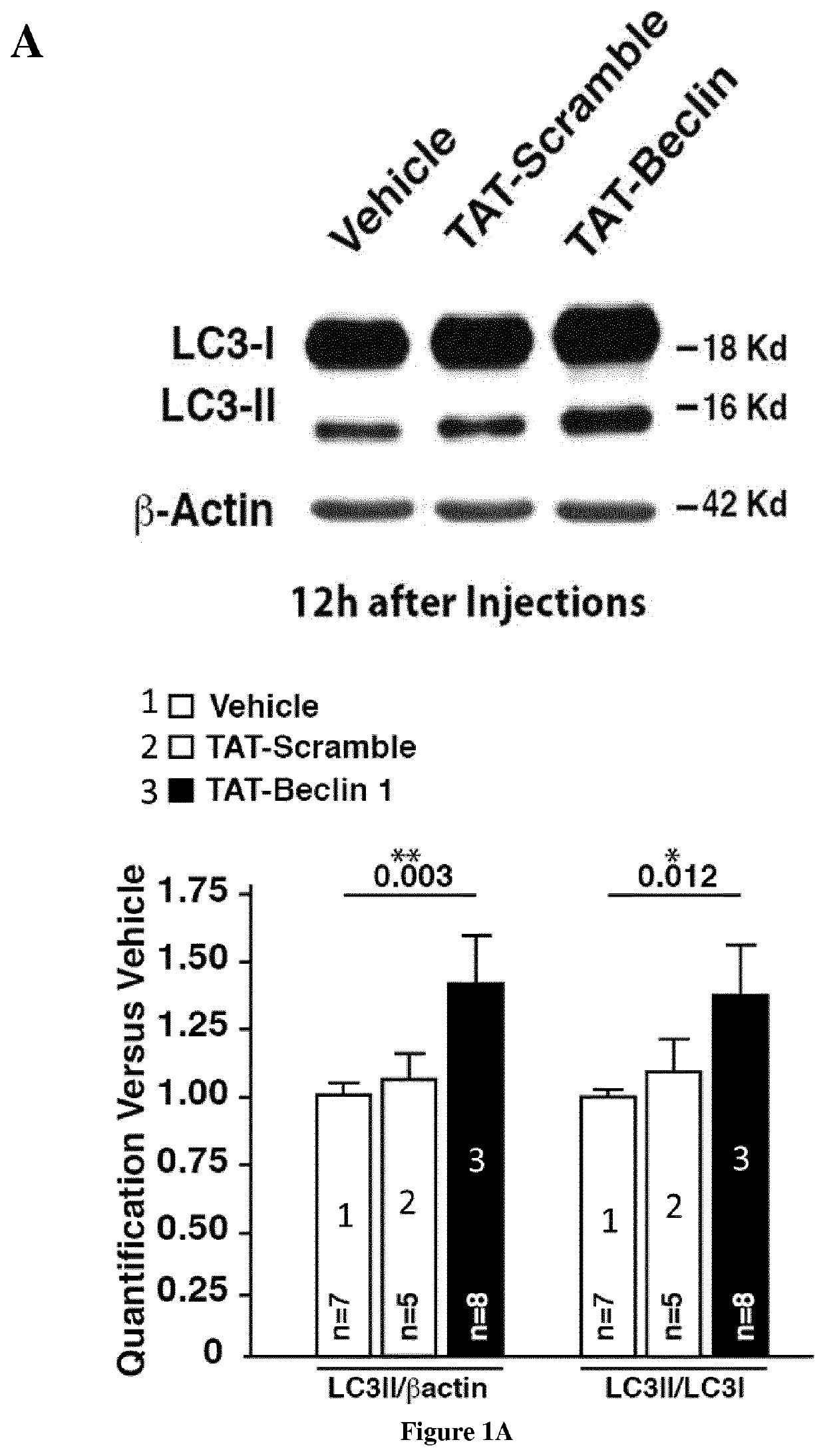 Method to restore or improve cognitive functions