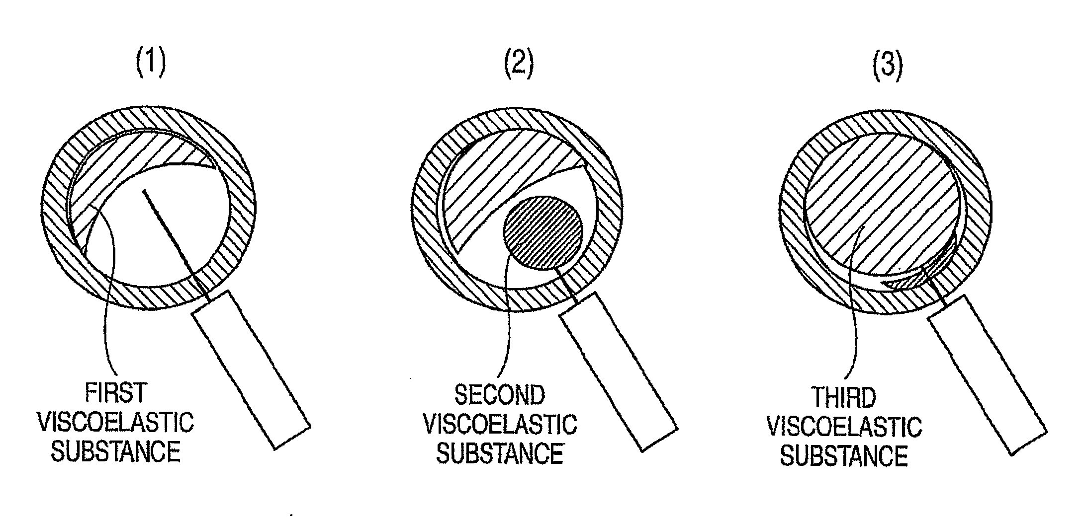 Method of ophthalmic surgery and kit therefor
