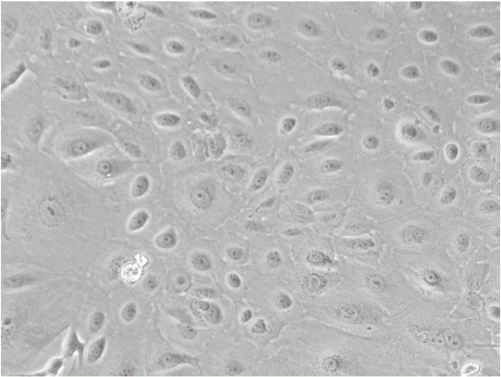 Method for preparing human amniotic membrane epithelial cells from human placenta amnion and application thereof