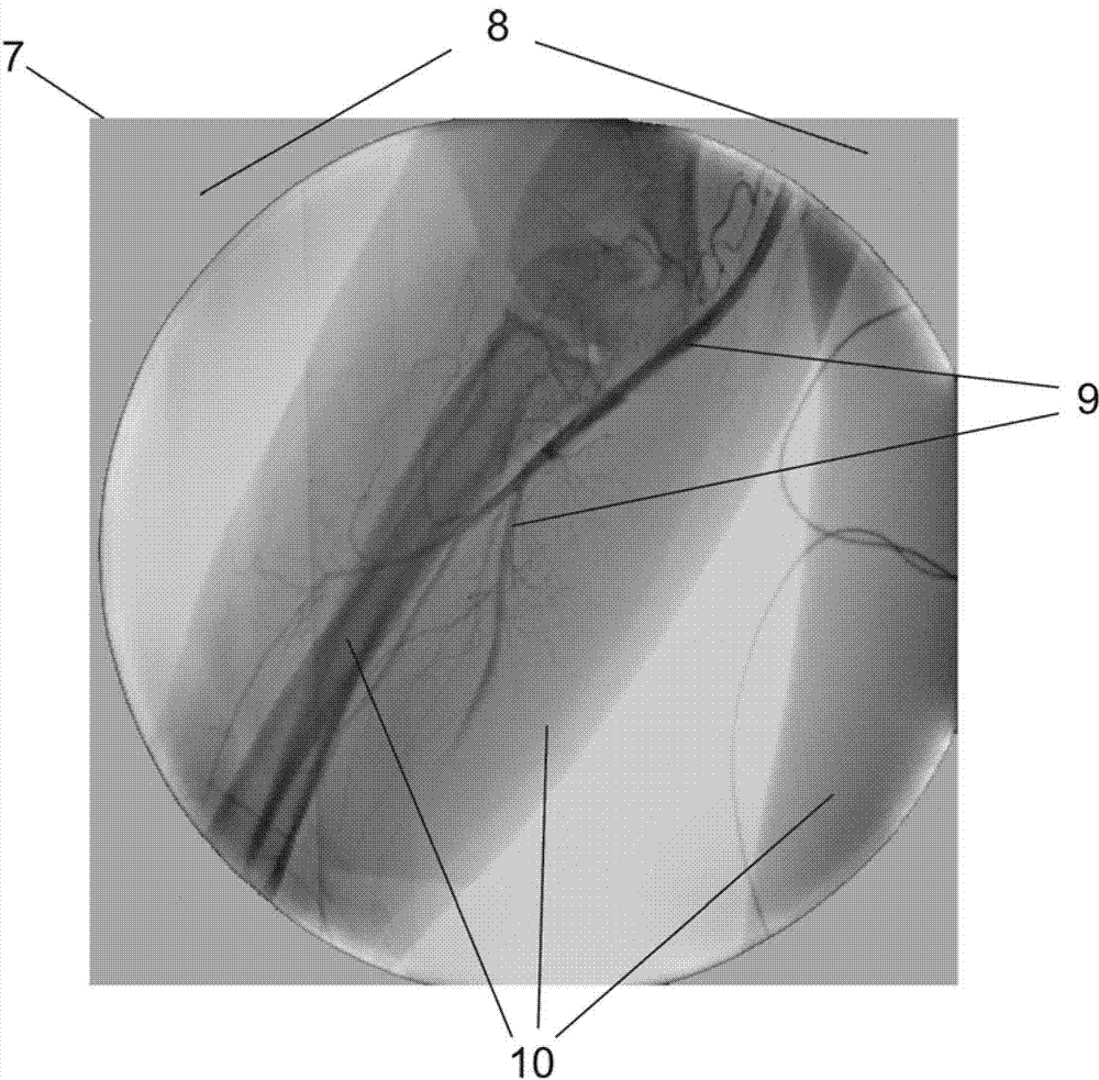 Method for acquisition of subtraction angiograms