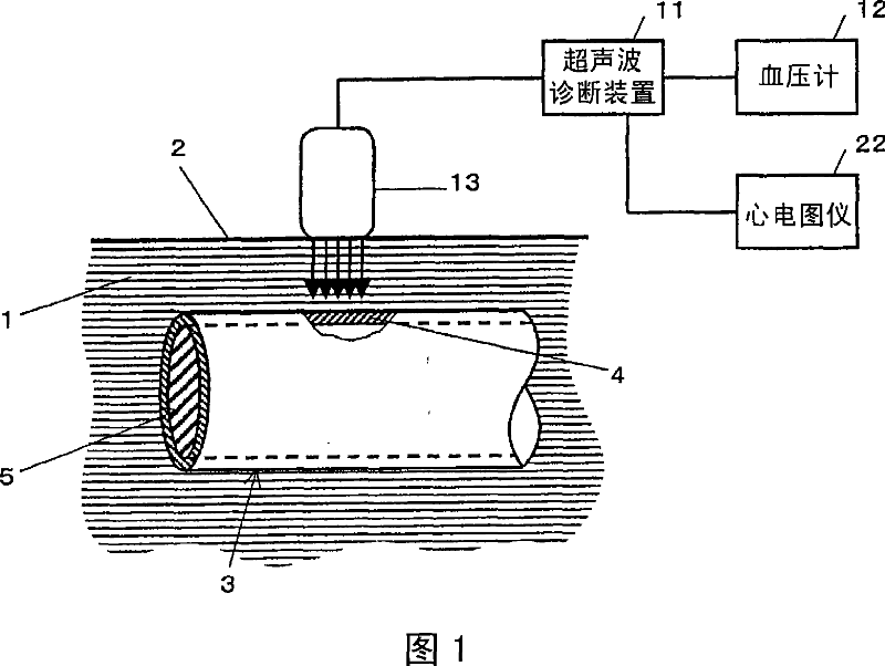 Ultrasonographic device and ultrasonographic device control method