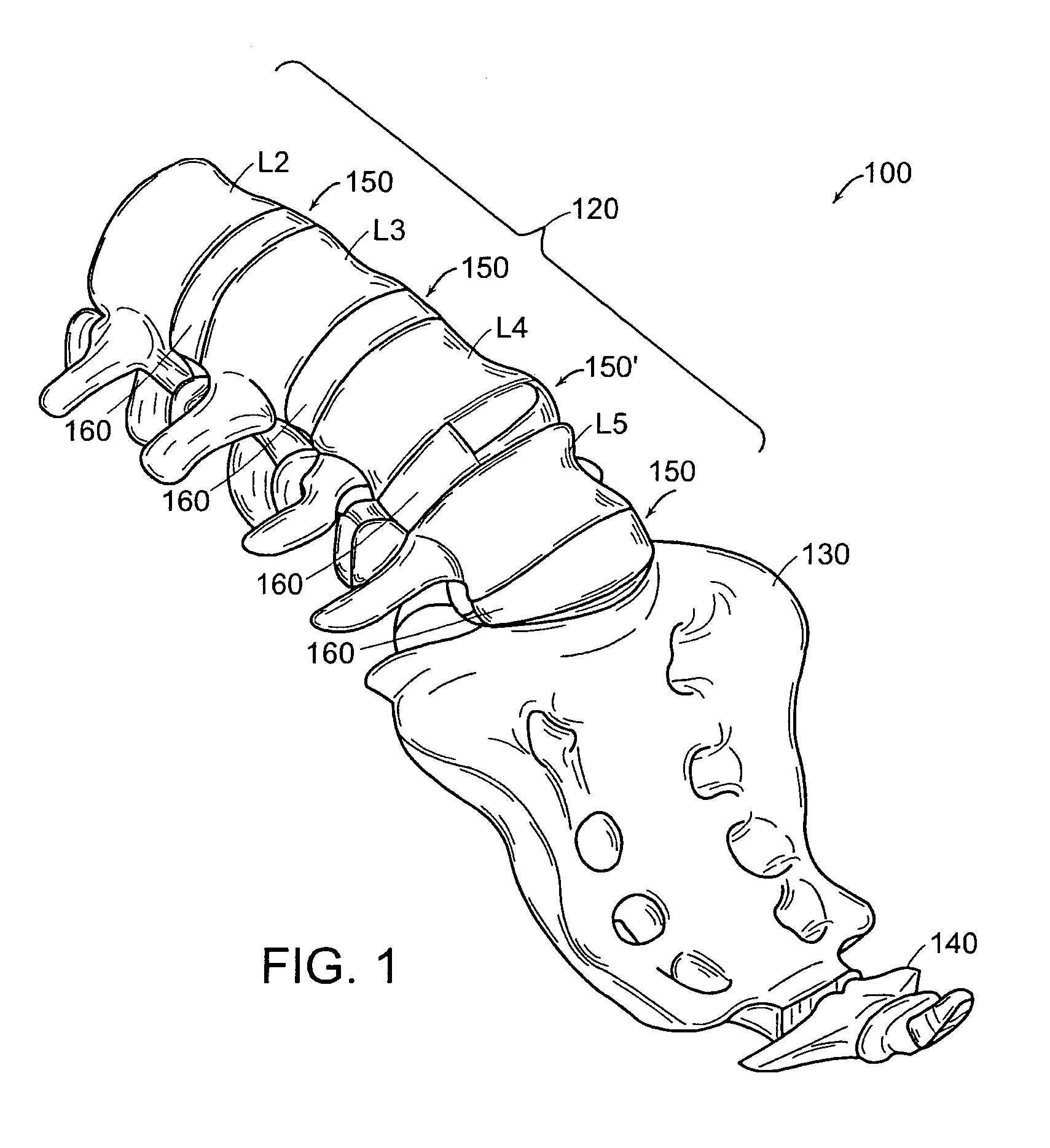 Method and apparatus for implant stability