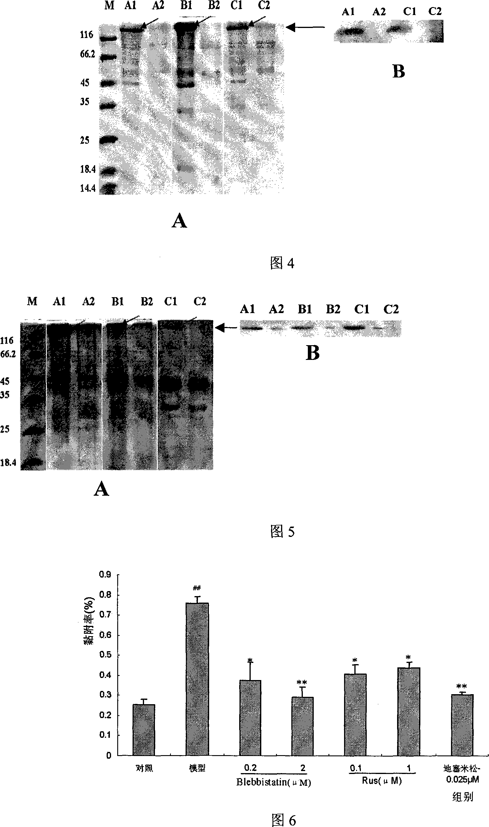 Medicine target for preventing and treating cardiovascular and cerebrovascular diseases associated with inflammation and its inhibitor