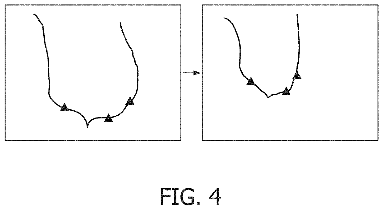 Registration of static pre-procedural planning data to dynamic intra-procedural segmentation data