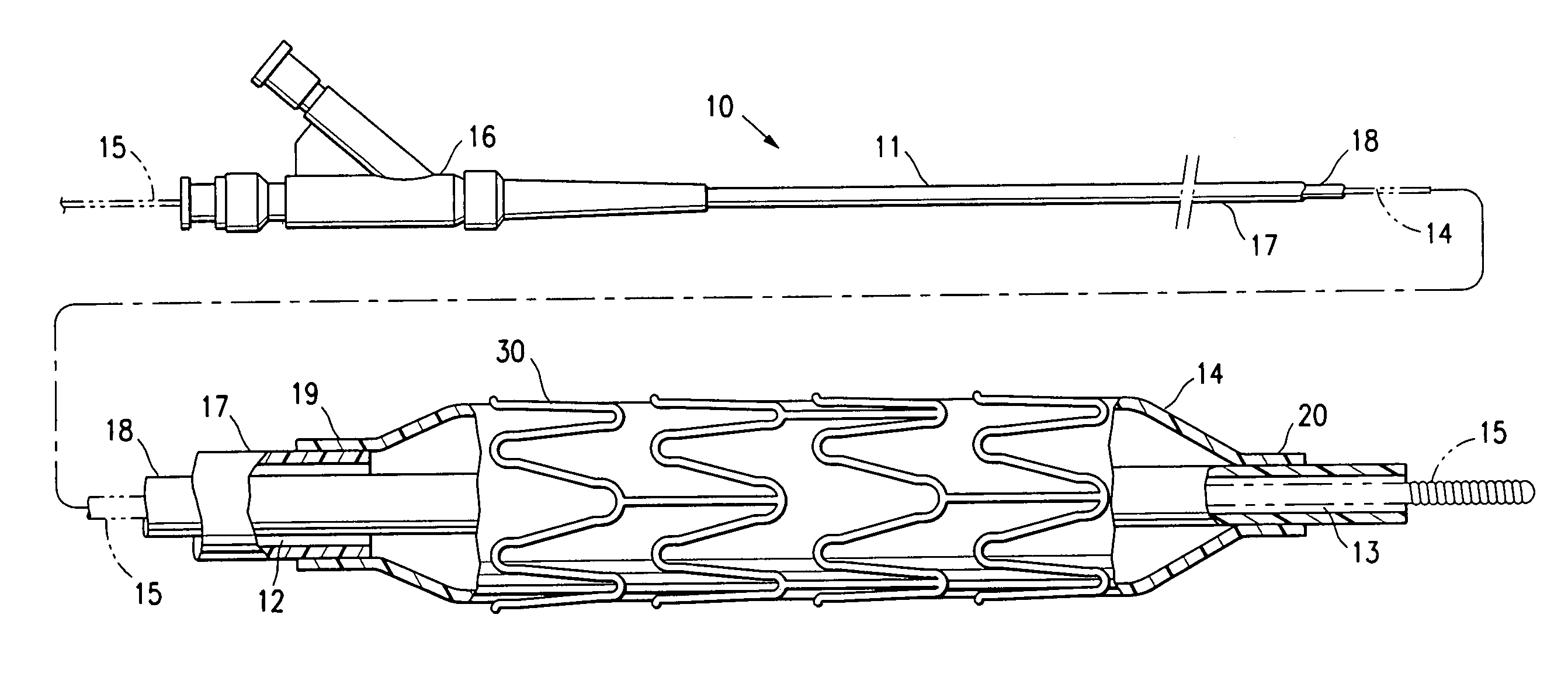 Stent delivery catheter with improved stent retention and method of making same