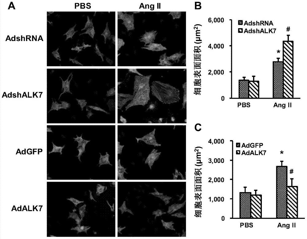 Function and application of activin receptor-like kinase7 (ALK7) in treatment of cardiac hypertrophy