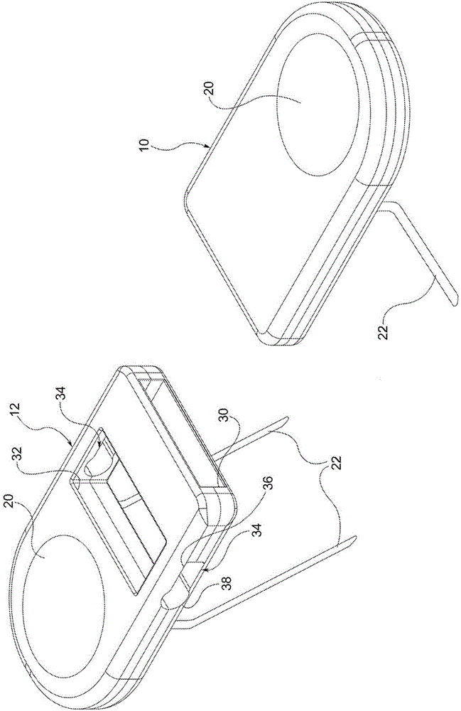 An instrument that stretches/expands skin tissue at the edges of ulcers, wounds