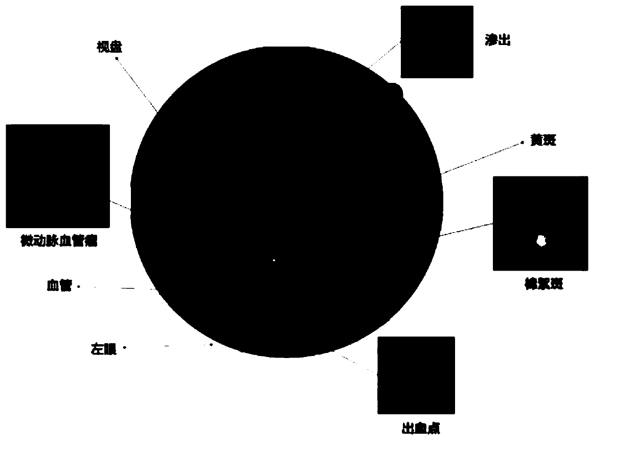 Multi-mode retinal fundus image registration method and device