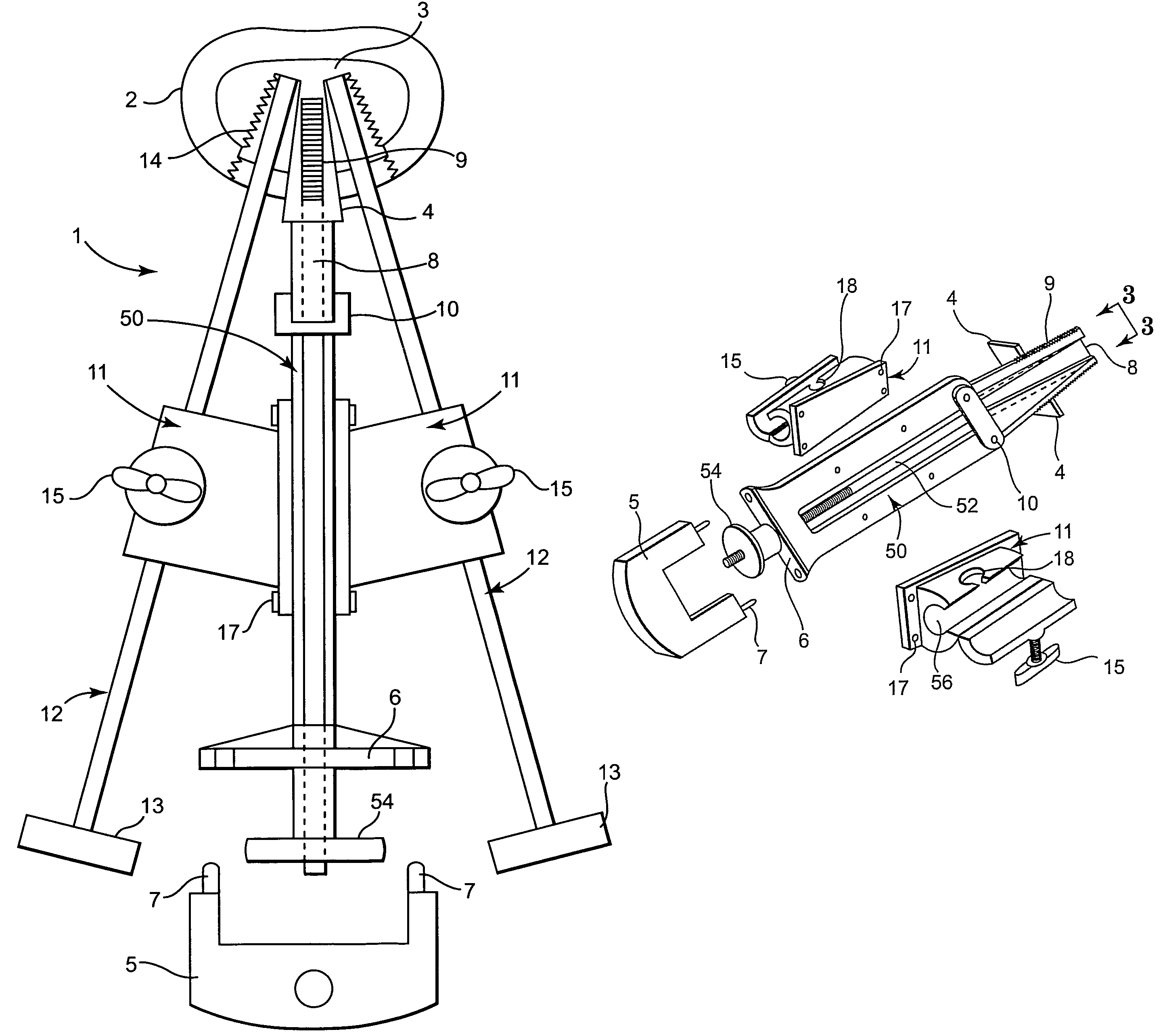 Tapered bone fusion cages or blocks, implantation means and method