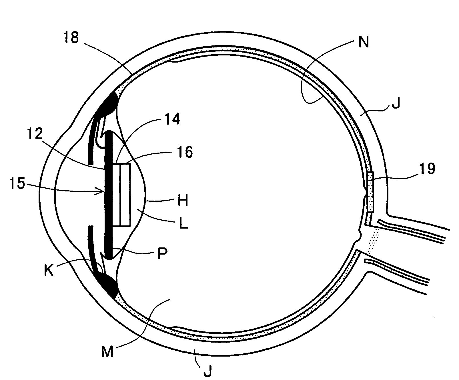 Artificial eye system