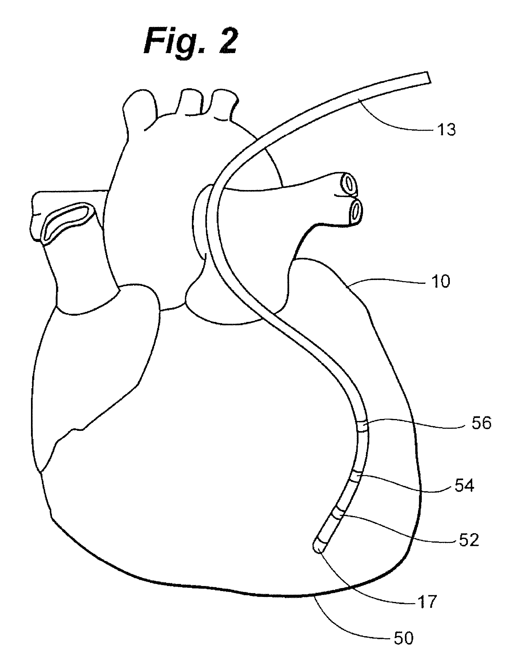 System and method for three-dimensional mapping of electrophysiology information