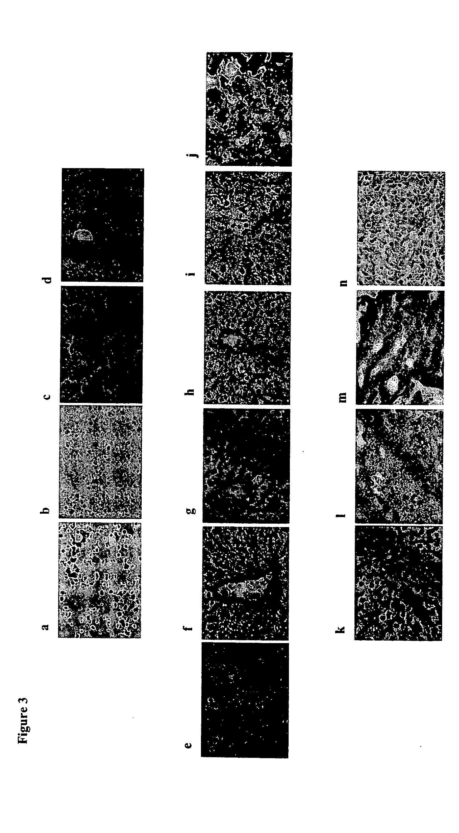 Human hepatic progenitor cells and methods of use thereof
