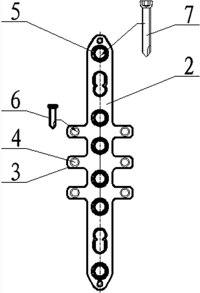 Ulna thread-type protection steel plate