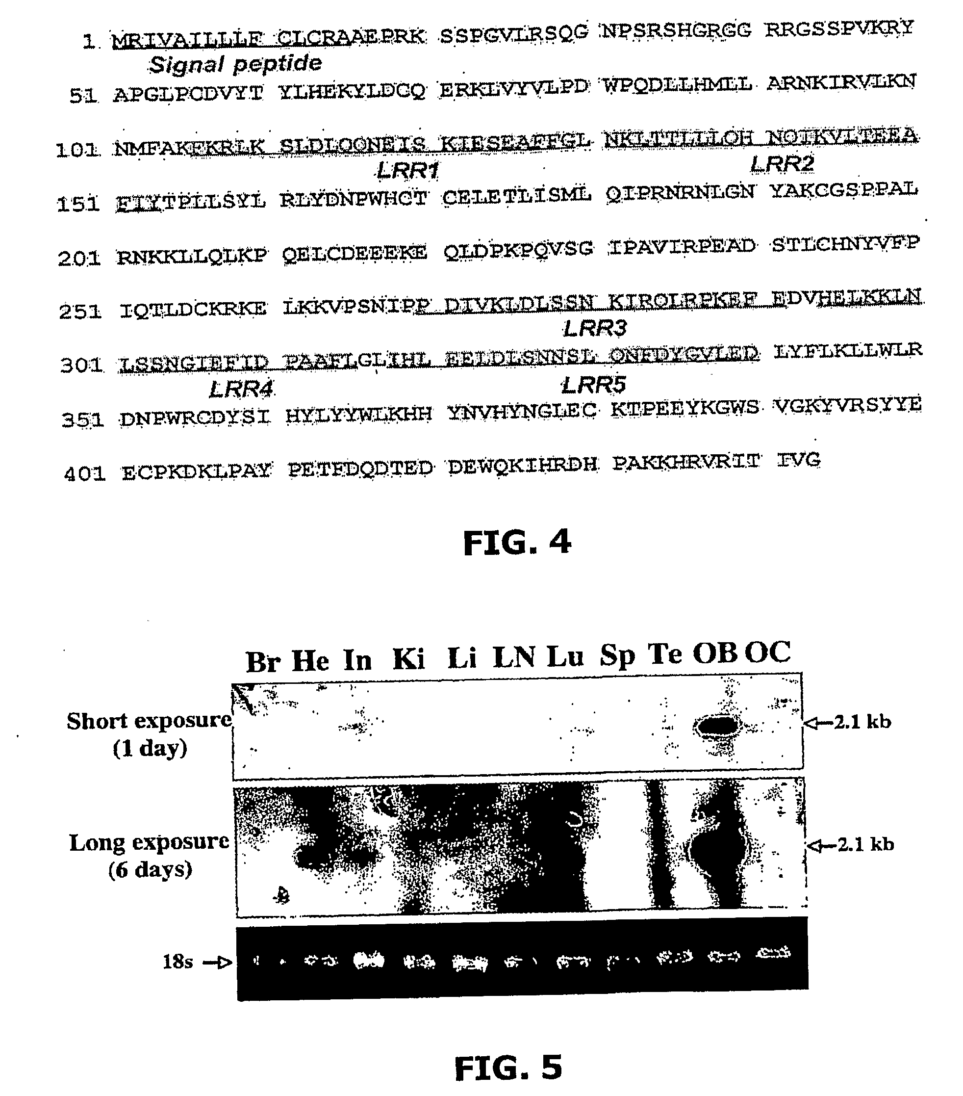 Compositions and Methods for Regulating Osteoclast Differentiation, Activation and Bone Resorption