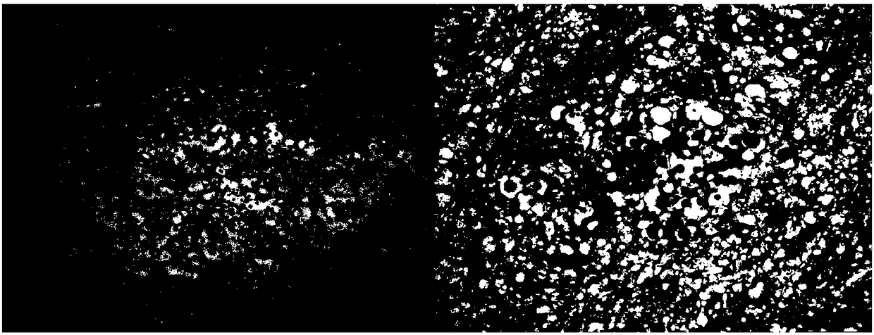 Method for simultaneously constructing experimental models of cryptococcal pneumonia and meningitis