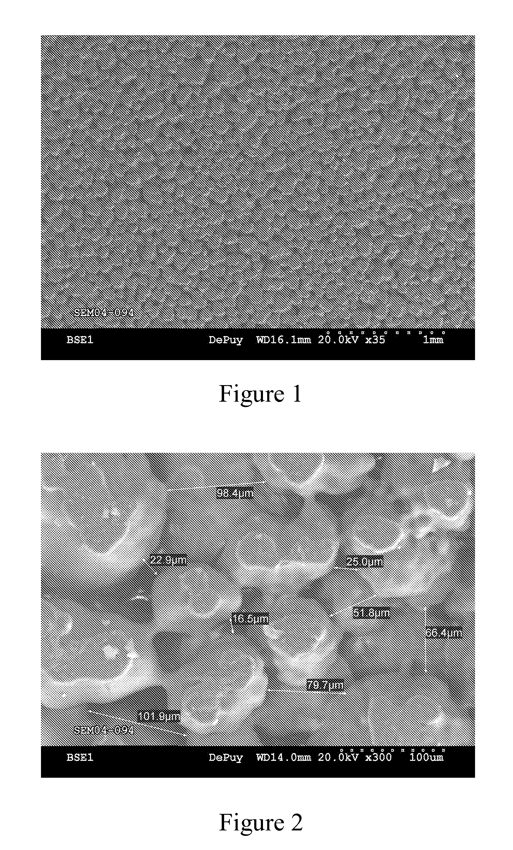 Medical implant or medical implant part comprising porous uhmwpe and process for producing the same