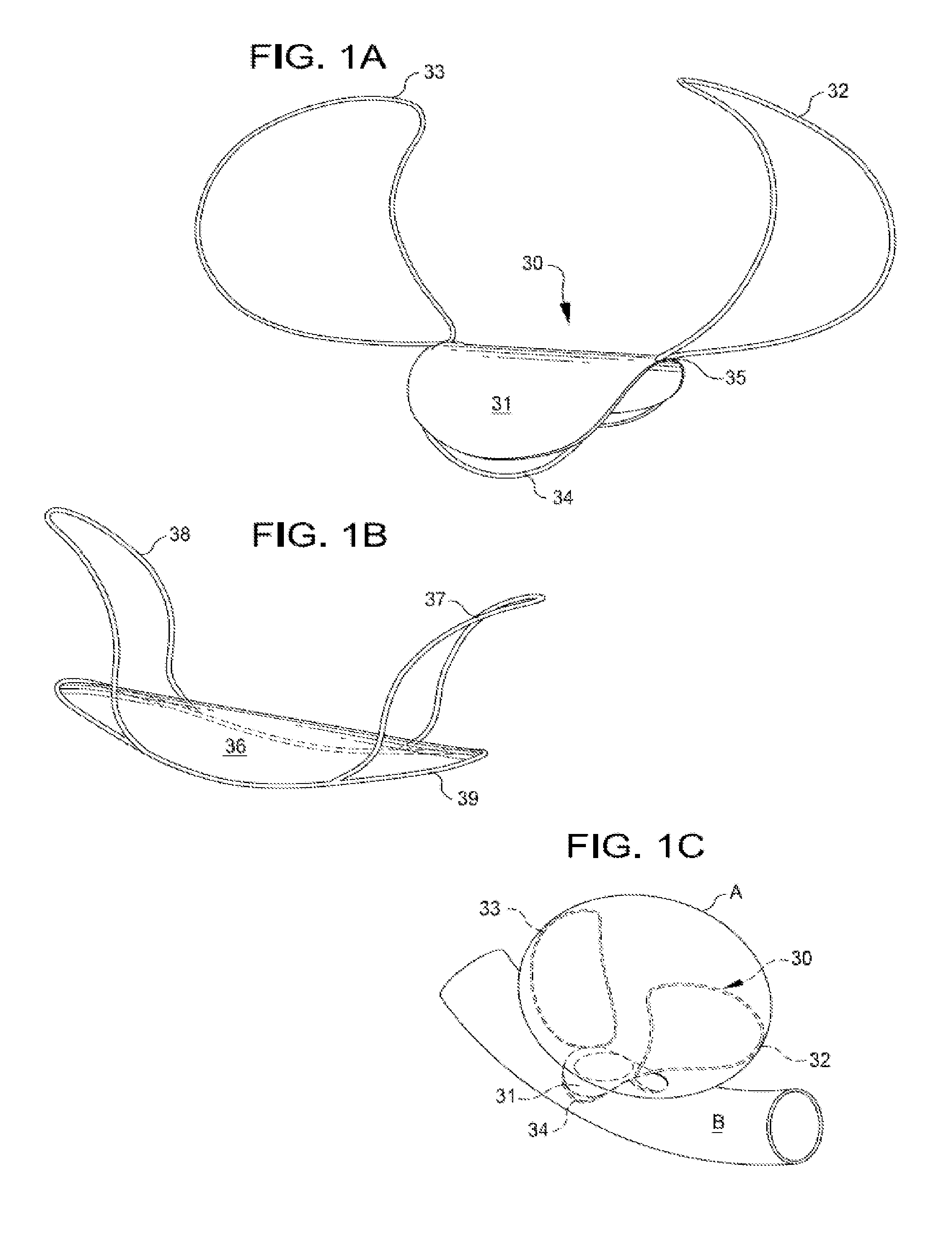 Methods and systems for endovascularly clipping and repairing lumen and tissue defects