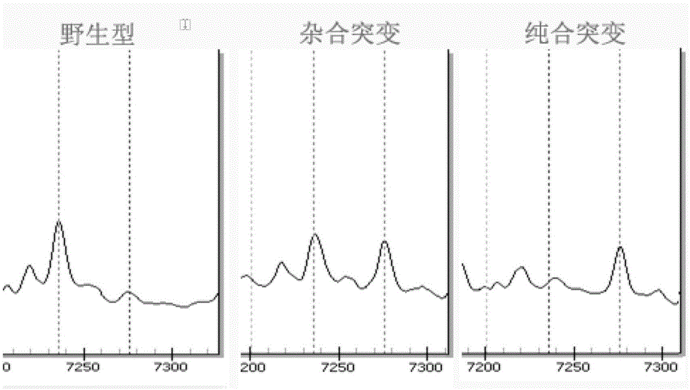 Method and kit for detecting human ATP7B gene mutation type