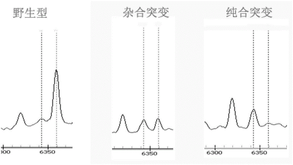 Method and kit for detecting human ATP7B gene mutation type