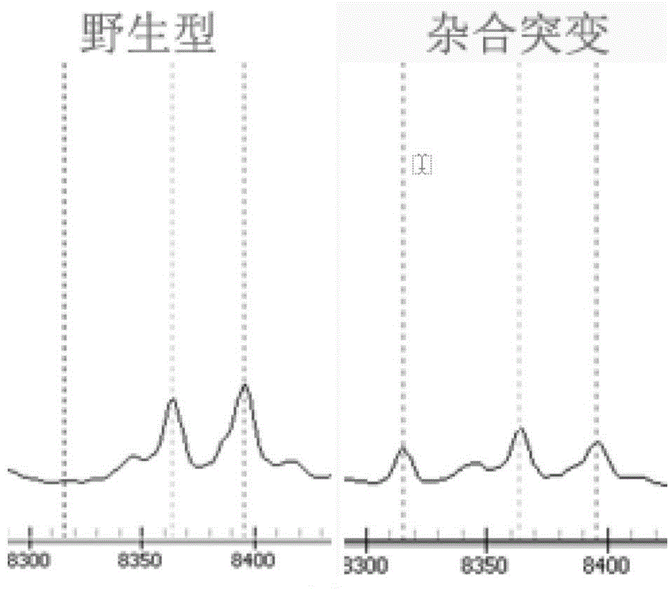 Method and kit for detecting human ATP7B gene mutation type