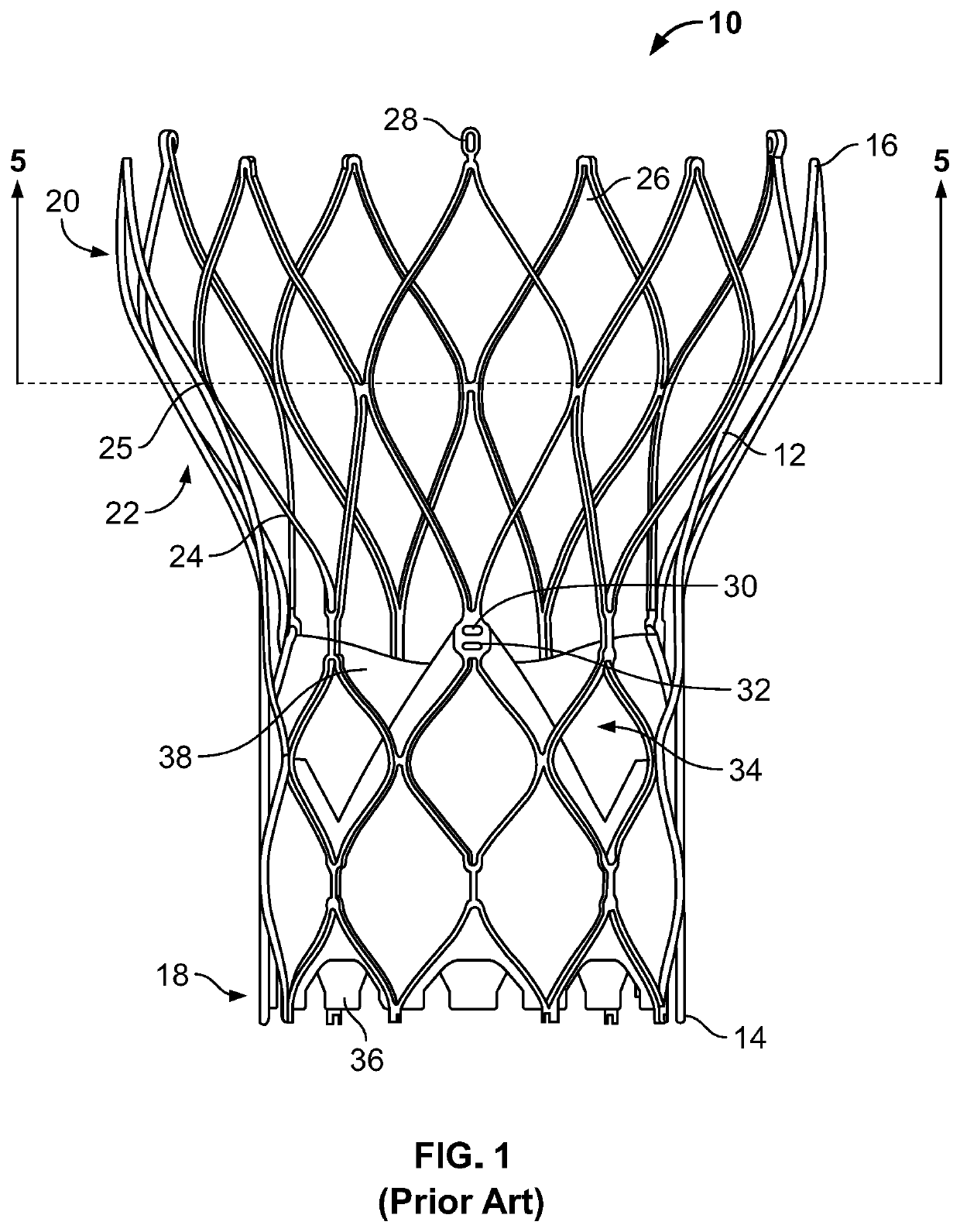 Fully Deployable And Recapturable Prosthetic Heart Valve