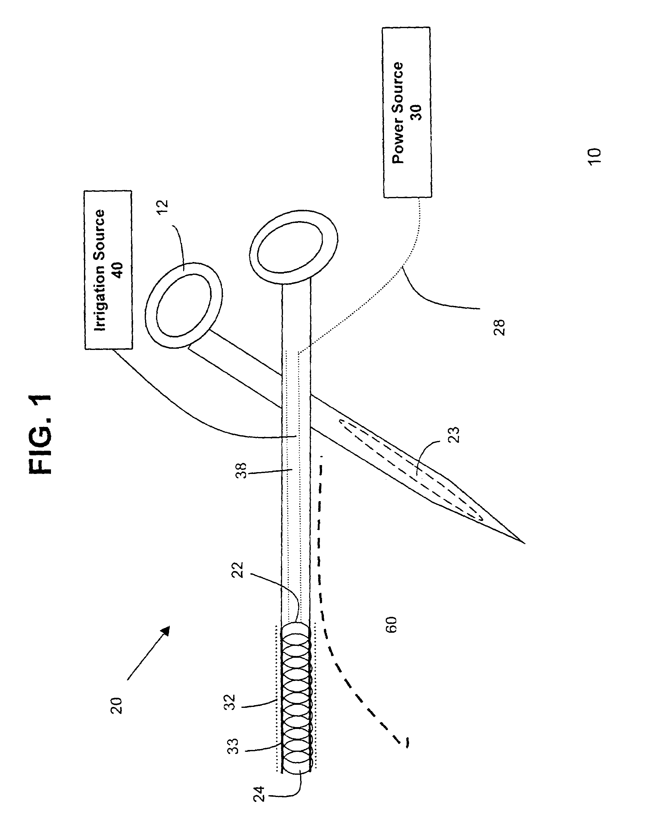 Method and apparatus for tissue ablation