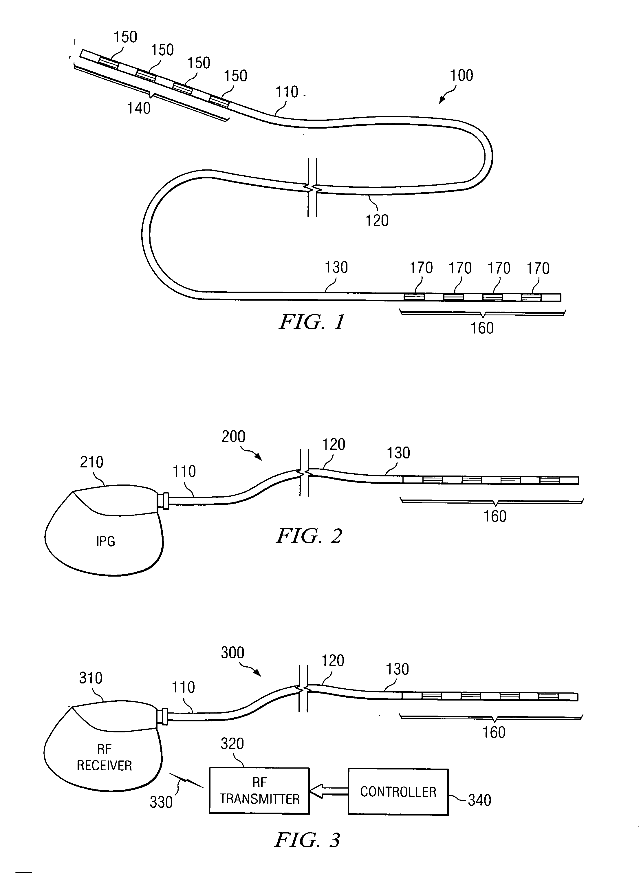 System and method for providing a medical lead body having dual conductor layers