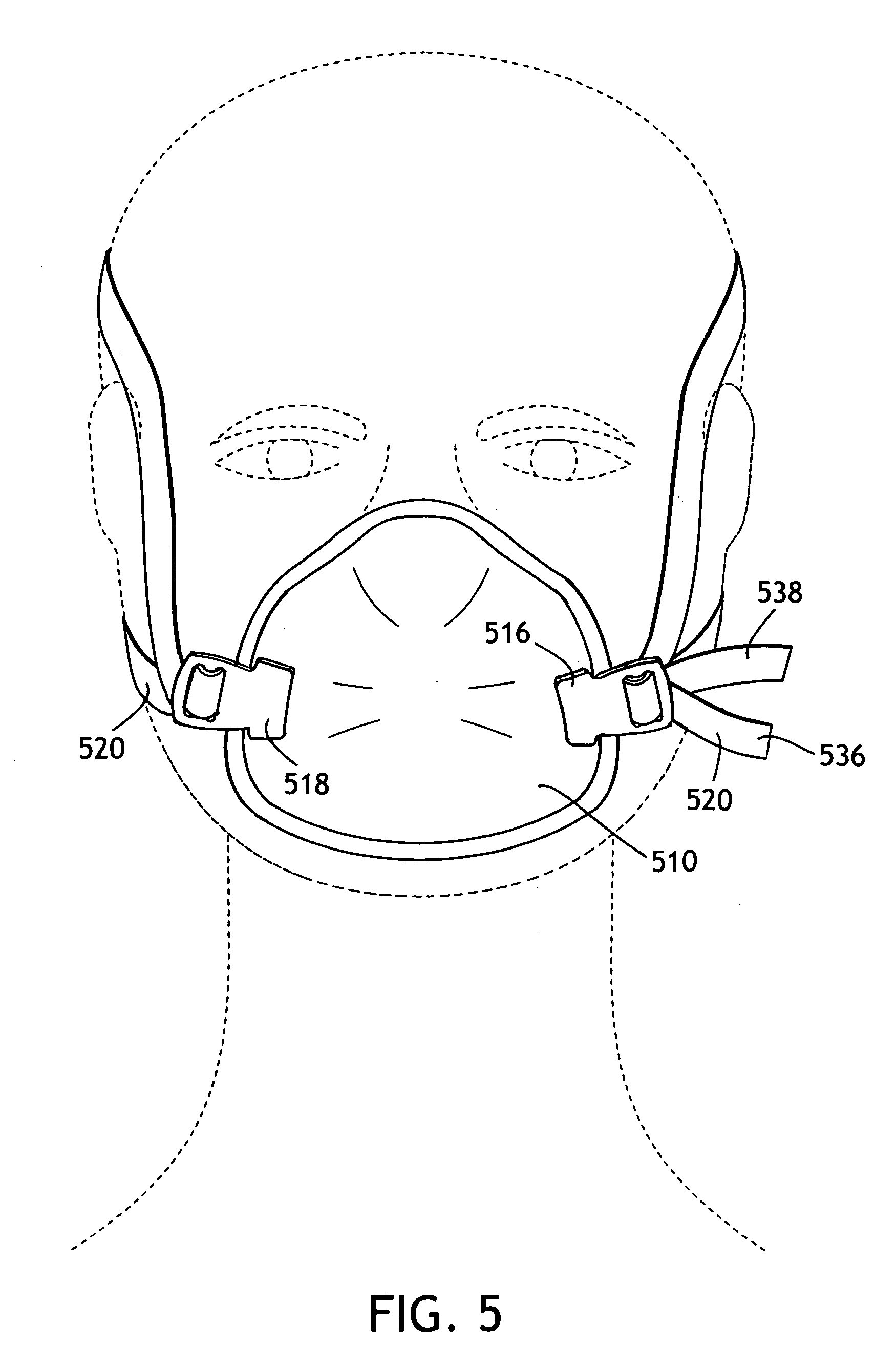 Strap fastening system for a disposable respirator providing improved donning