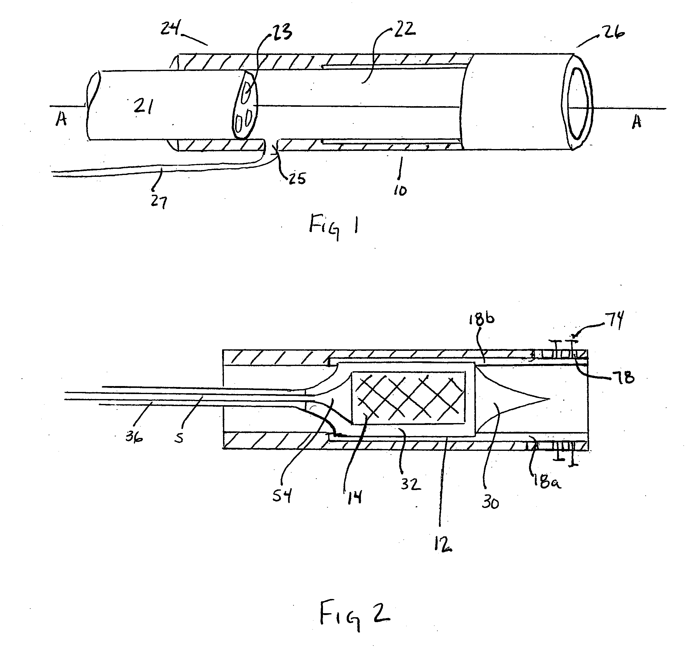 Methods and apparatus for securing an anchor to soft tissue
