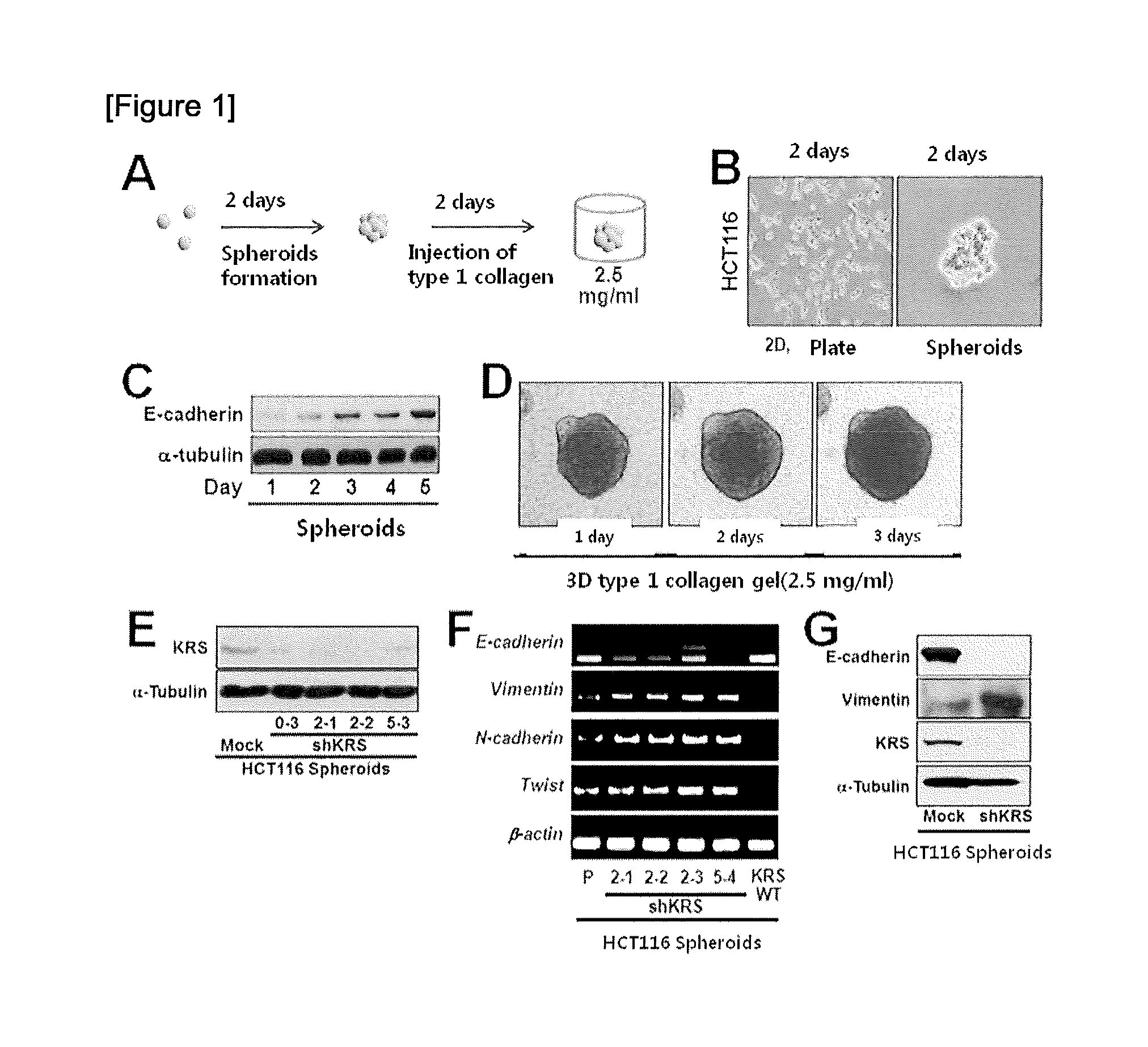 Method for screeing cancer metastasis inhibitor using culture of cells or spheroidically aggregated cells in which lysyl-trna synthetase is regulated to be expressed or unexpressed