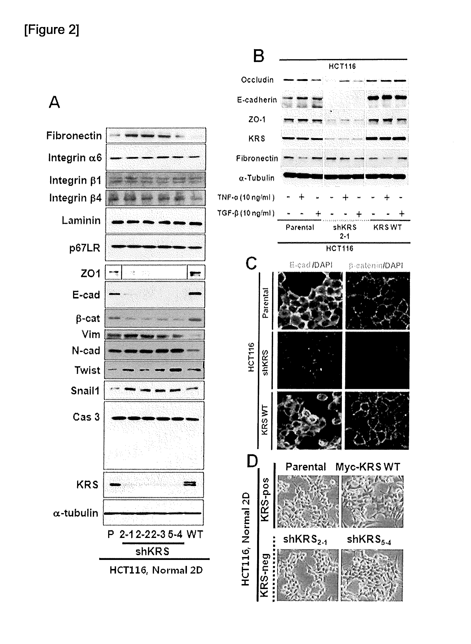 Method for screeing cancer metastasis inhibitor using culture of cells or spheroidically aggregated cells in which lysyl-trna synthetase is regulated to be expressed or unexpressed