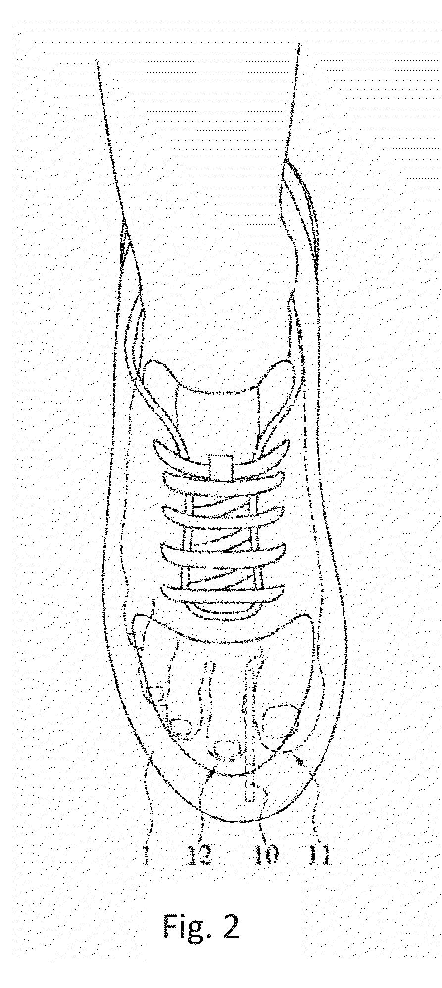 Shoe Structure