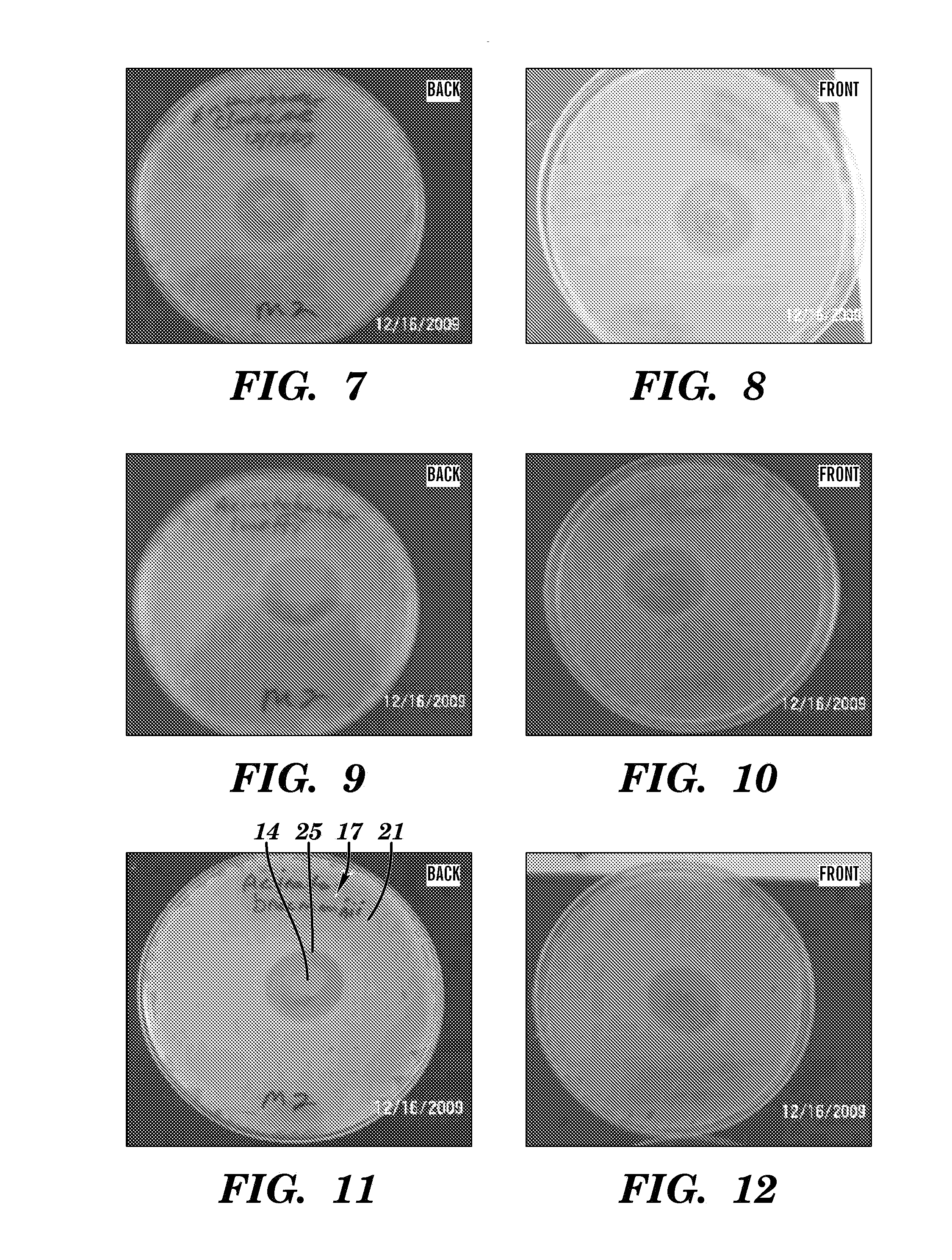 Topical drug delivery system with dual carriers