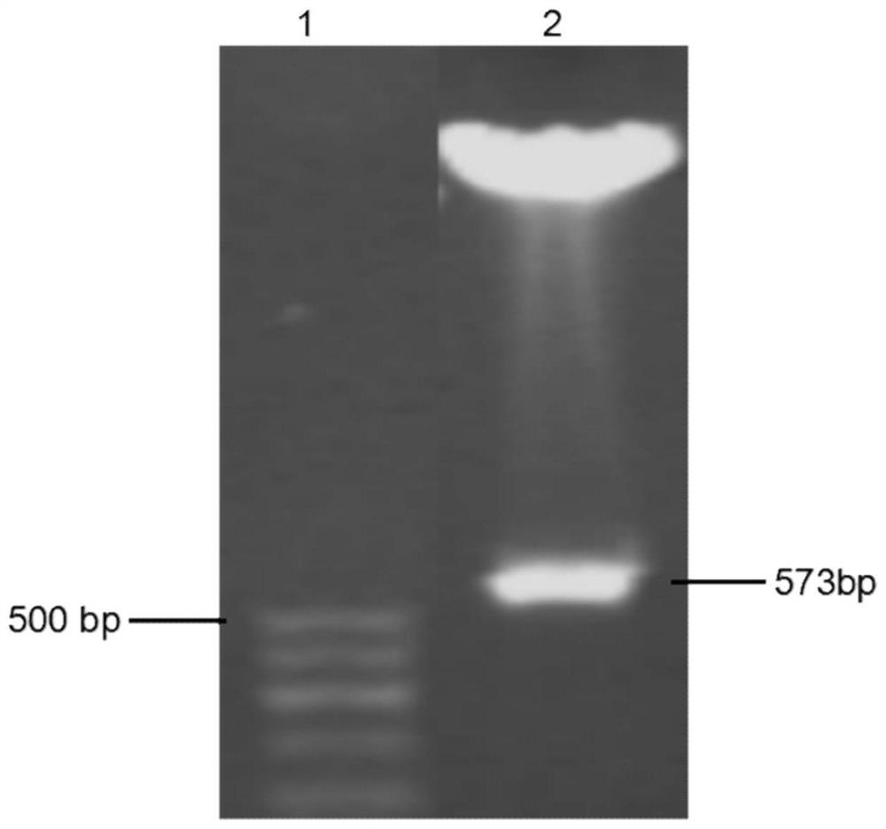 Human wnt5a-nl nucleic acid recombinant and its preparation method and application